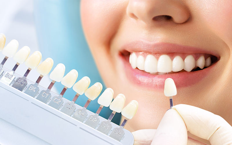 ホワイトニング